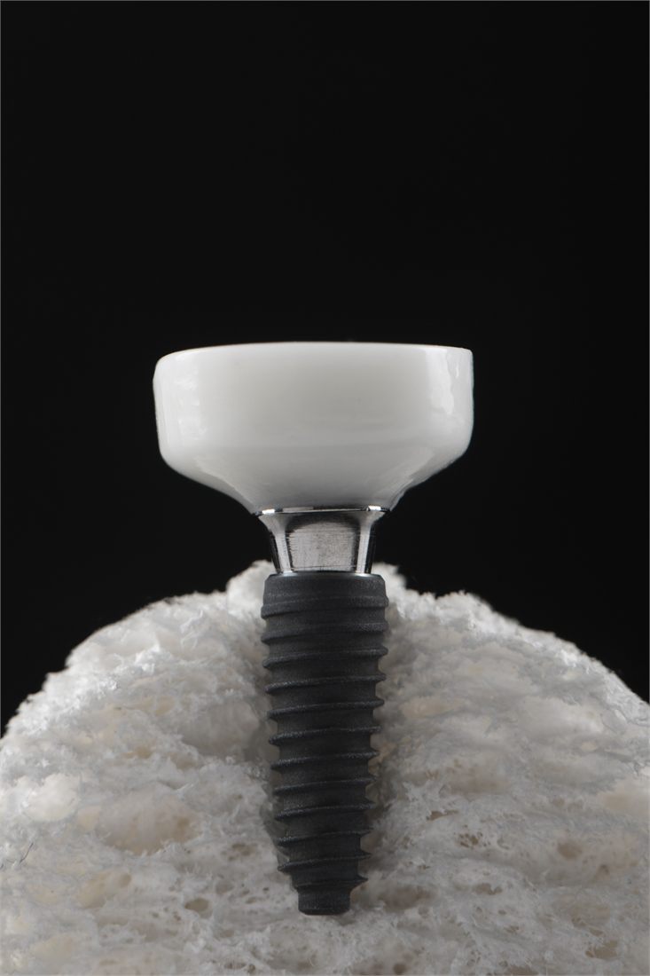 Anatomical custom healing abutment in composite