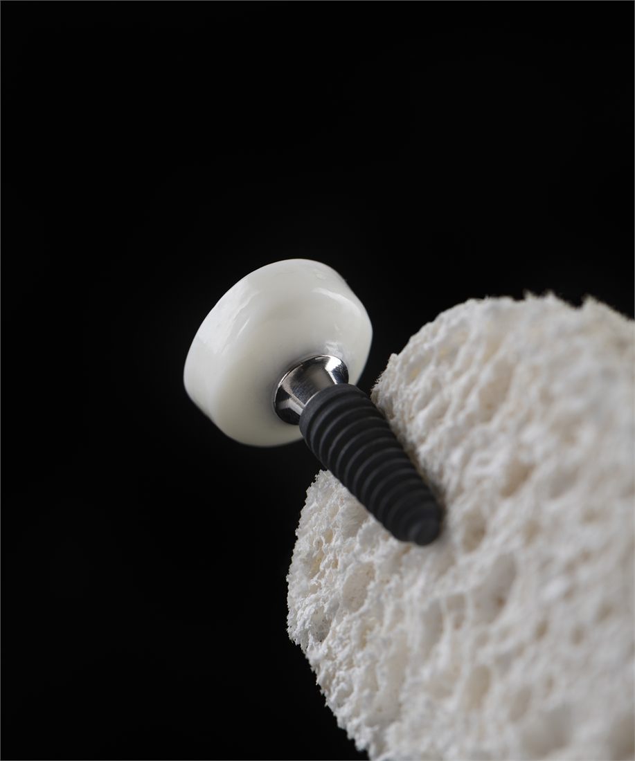 Customised gingival former in composite