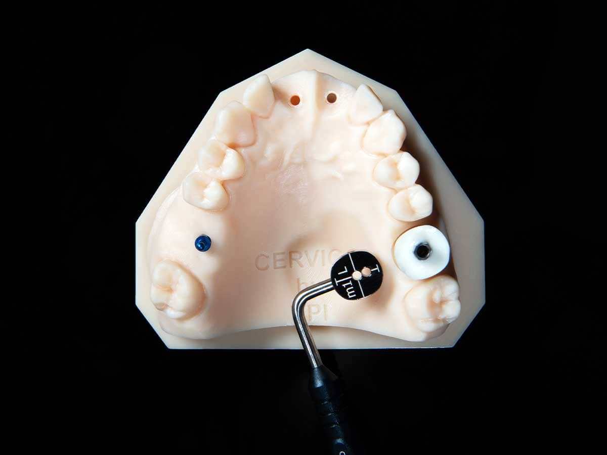 Cervico Premium Mold — Instructions for Use